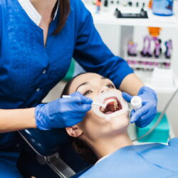Znieczulenie u dentysty - rodzaje i zastosowania znieczuleń w gabinecie stomatologicznym