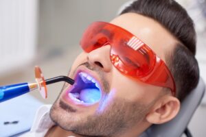 skuteczne wybielanie zębów w gabinecie stomatologicznym lampą
